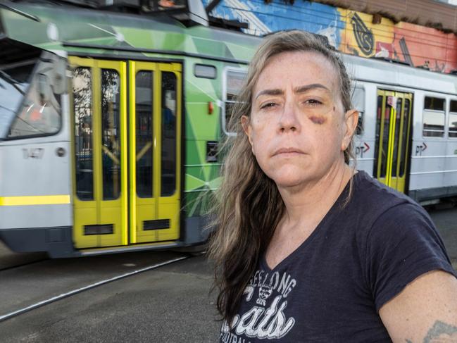 Caitlin Morrison was assaulted on a Melbourne tram. She is now campaigning for CCTV on trams across Melbourne. Picture: Tony Gough