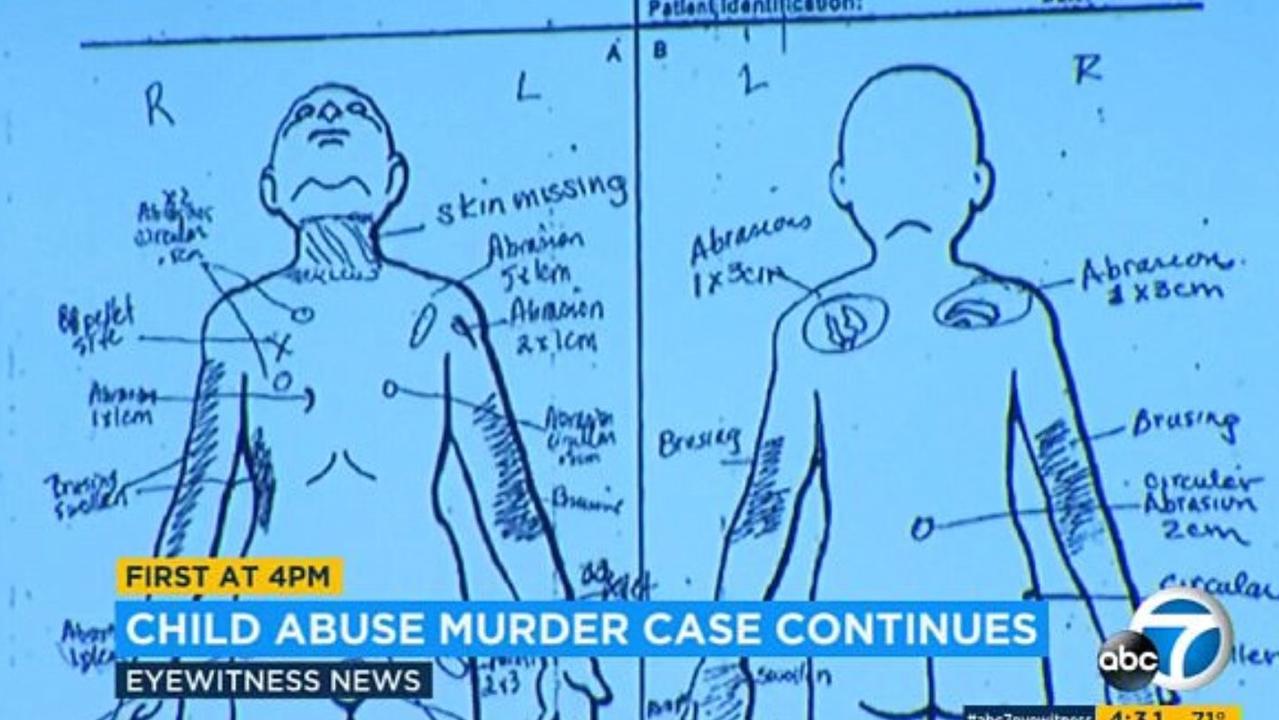 A diagram shown in court labelling all of Gabriel’s injuries.