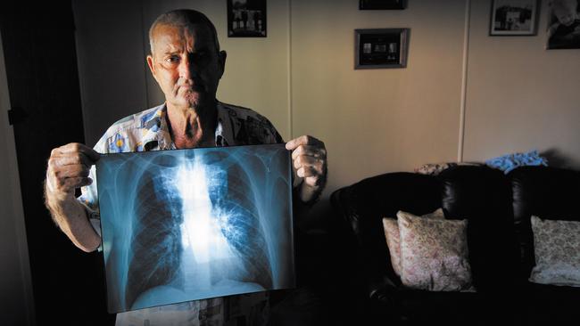 Percy Verrall was the first Australian diagnosed with black lung disease in 30 years.