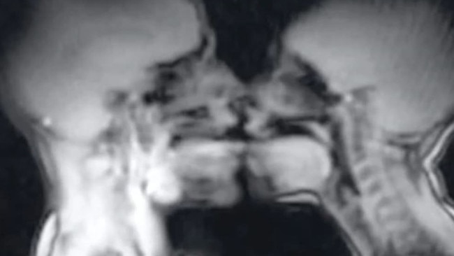 In 1991, a couple had sex in an MRI machine, and the story is going viral on TikTok. Picture: BMJ