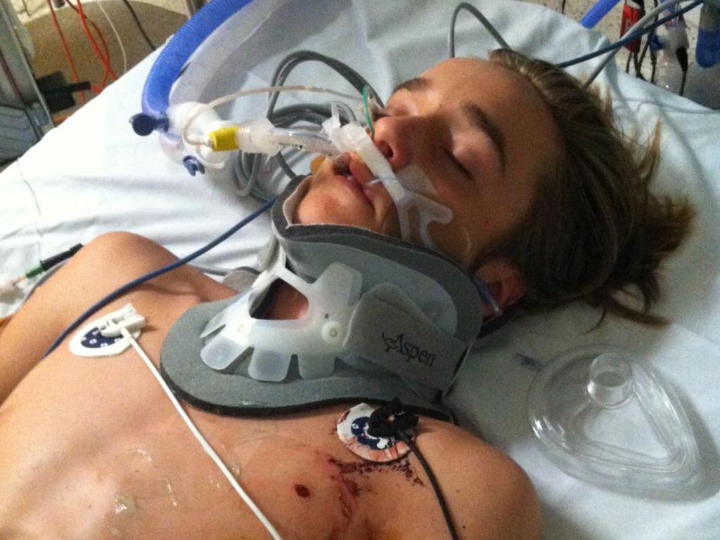 The teen was in hospital for 11 days after the accident. Picture: Supplied