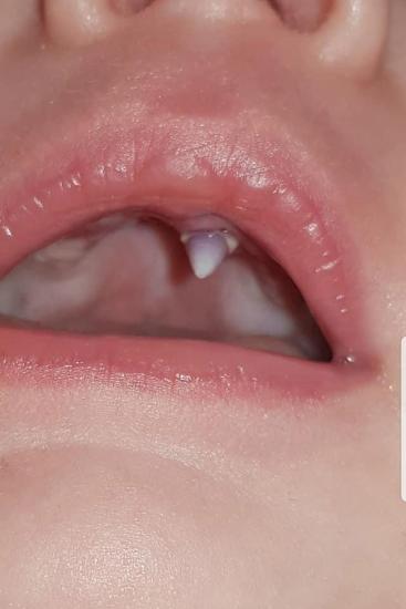 11 week old teething
