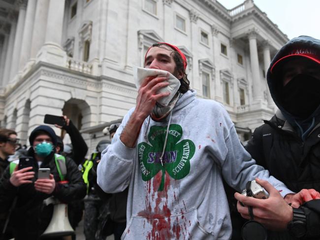 A protester is injured during the Capitol riots on January 6 in Washington, DC. Picture: AFP