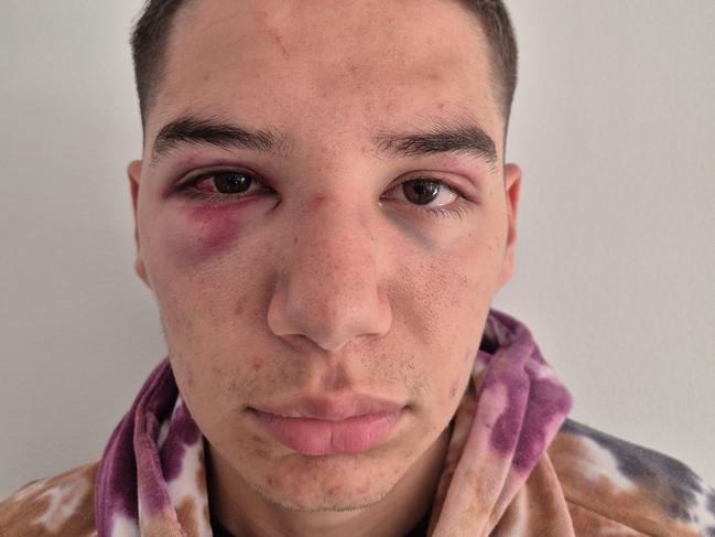 A public high school in the Hunter is under pressure to explain what it is doing to keep its students safe, after a "gang" of boys brutally bashed a Year 12 student on a bus after leaving school., NSW Police are now investigating the assault which left 17 year old Kobe Pratt with a fractured nose, eye injuries, and multiple bruises to his skull., Kobe was attacked at about 3.10pm last Friday after leaving school at Irrawang High School in Raymond Terrace.