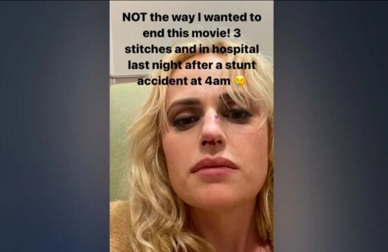 Rebel Wilson Hospitalised After Stunt Goes Wrong On Bride Hard Film Set ...