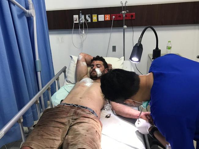 Nicholas Carr, 26, from Adelaide is recovering in hospital. Picture: Lukman S. Bintoro