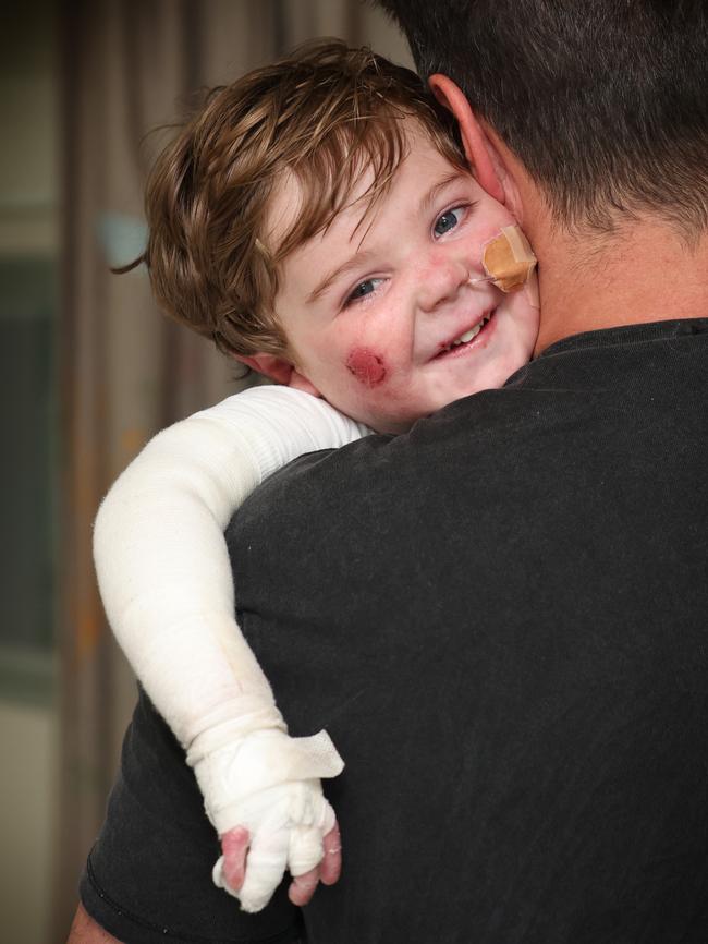 Little Jacob has a team of 12 NDIS and RCH nurses looking after him on a 24/7 rotating roster. Picture: David Caird