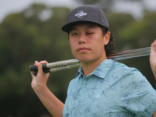 Young Australian golfer Jeff Guan talks for the first time after he was hit by a golf ball in the eye at a Pro Am event in September. Photo: David Tease/Golf NSW.