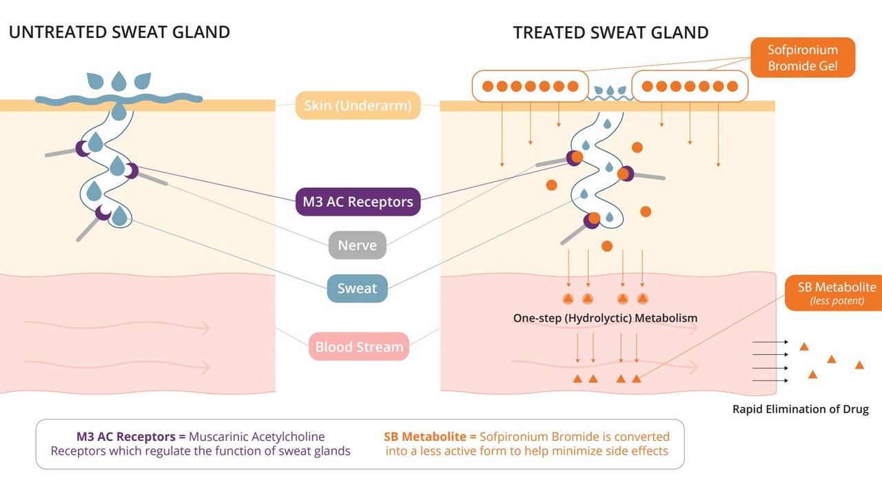 Excessive sweating is a more widespread problem than most people think, according to Botanix. Picture: Supplied