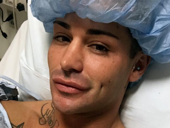 Joey is no stranger to plastic surgery. At the age of 26 he’s already had 100 procedures. Picture: Caters News