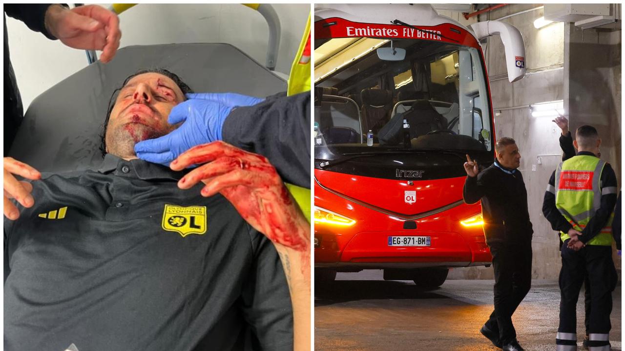 Football: Marseille-Lyon postponed after bus attack, Fabio Grosso injury photos, video, latest