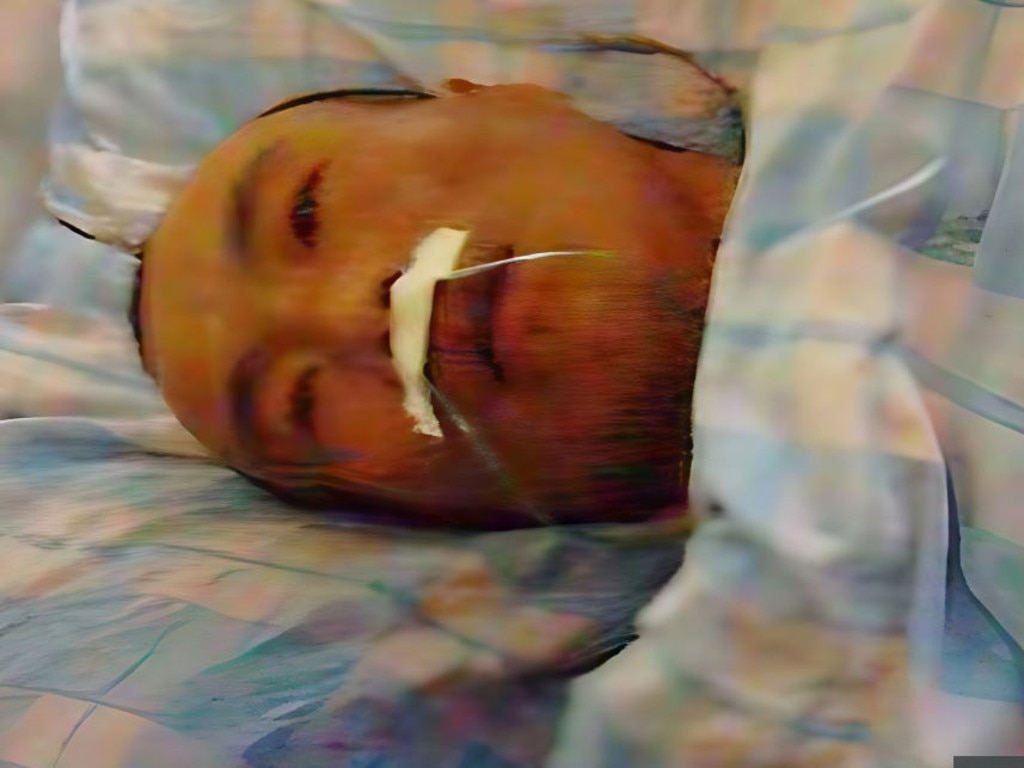 Cheng in hospital after an allegedly forced operation.