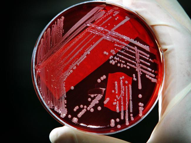 Infectious diseases physician Dr Wendy Munckhof holds a blood sugar dish of MRSA strain at the Princess Alexandra Hospital in Brisbane. Munchkhof is leading the study of a new antibiotic-resistant superbug, a strain of golden staph.