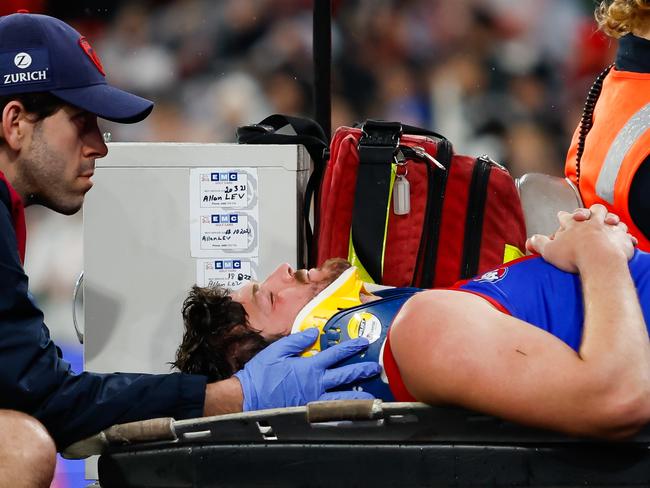 MELBOURNE, AUSTRALIA - SEPTEMBER 07: Angus Brayshaw of the Demons leaves the field on a stretcher during the 2023 AFL First Qualifying Final match between the Collingwood Magpies and the Melbourne Demons at Melbourne Cricket Ground on September 07, 2023 in Melbourne, Australia. (Photo by Dylan Burns/AFL Photos via Getty Images)