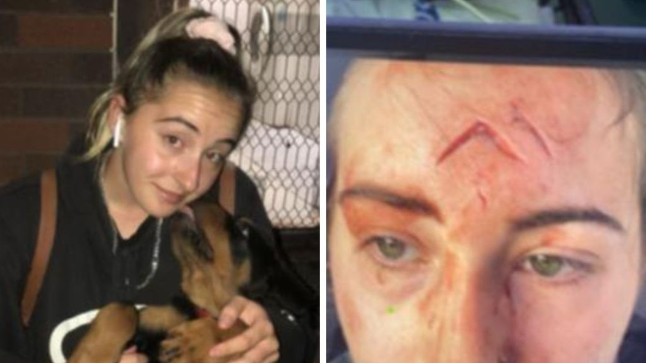 Woman brutally mauled by friend’s dog