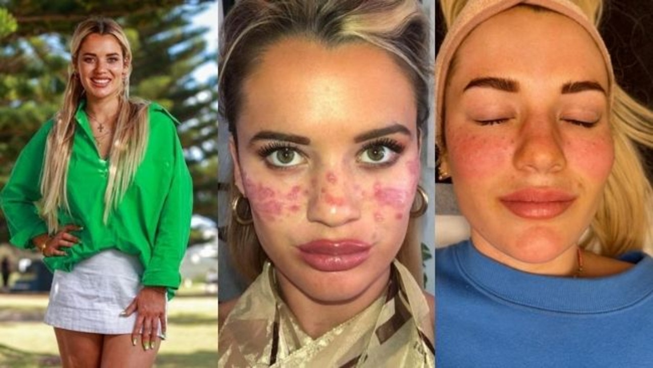 Aussie bloggers share ‘dangerous’ graphic DIY videos | Herald Sun