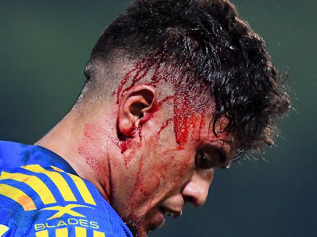 Parramatta Eels Kaysa Pritchard copped a head wound during Saturday's game against the North Queensland Cowboys at TIO stadium in Darwin, NT.Picture: Justin Kennedy