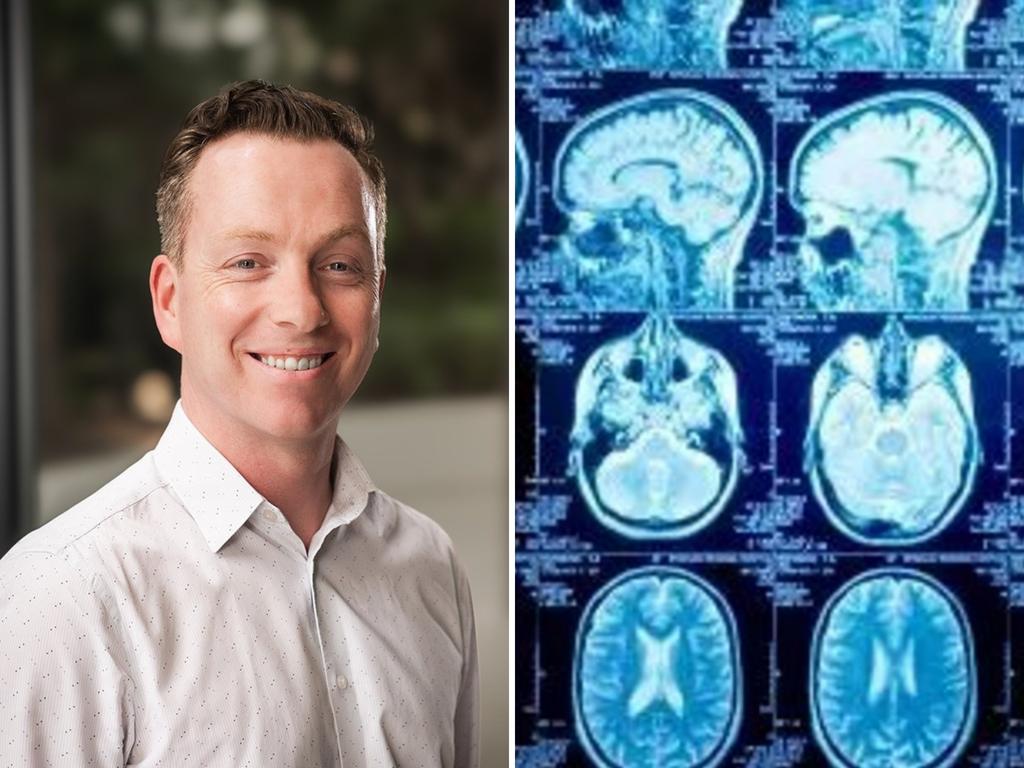 Monash University researcher Chris Moran’s study shows brain health is improved by exercise.