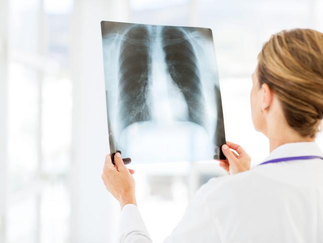 Doctors are concerned the non-reporting of X-rays could lead to early and treatable cancers being missed. Picture: supplied.