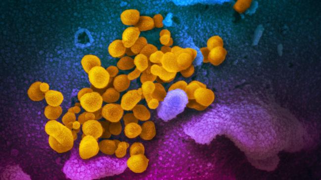 A scanning electron microscope shows SARS-CoV-2 (yellow)—also known as 2019-nCoV, the virus that causes COVID-19—isolated from a patient, emerging from the surface of cells (blue/pink) cultured in a US health lab. Picture: AFP