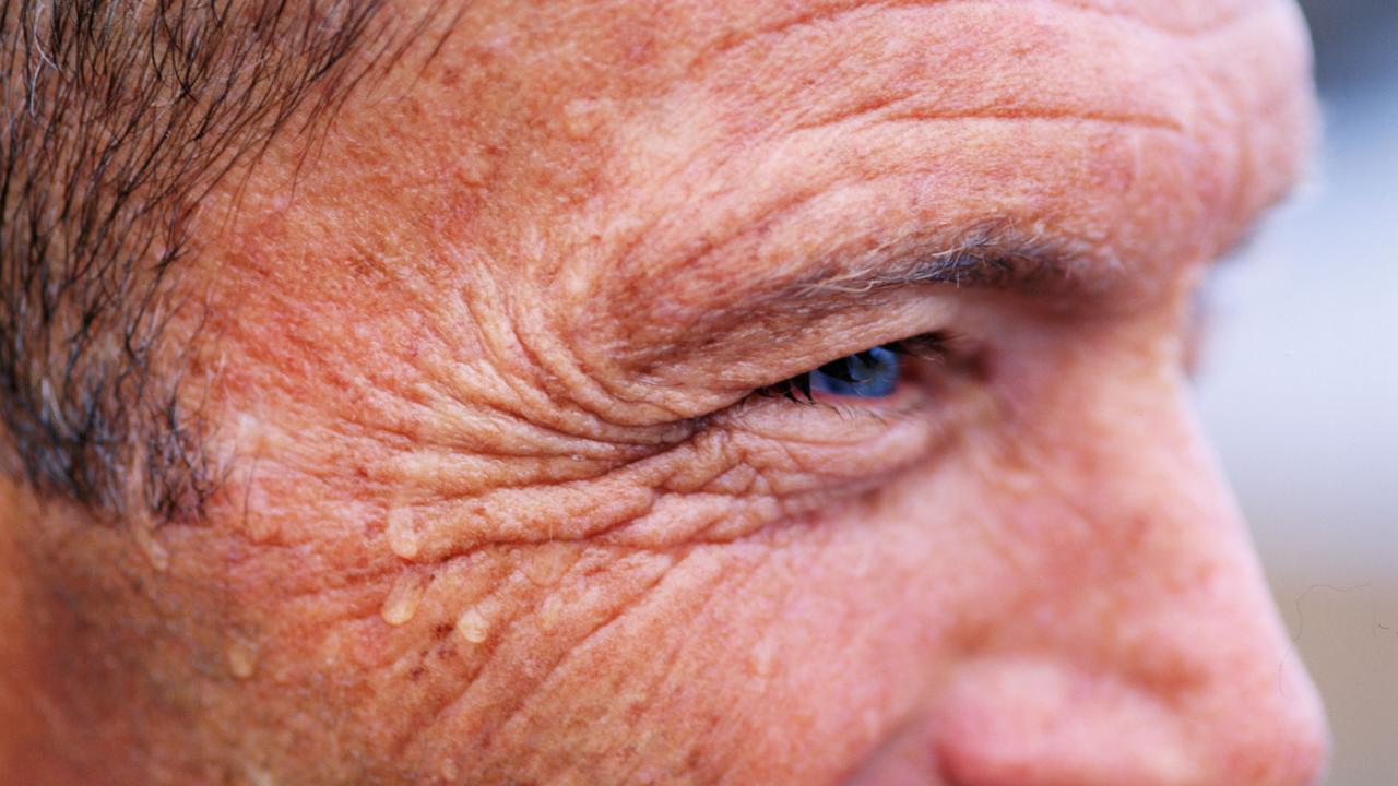 Generic Thinkstock images relating to Botox facial beauty treatment. Close up of man with wrinkles on face.
