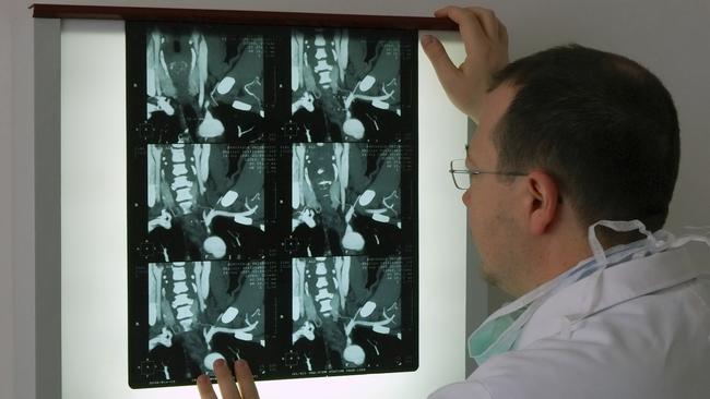 A resident told of a 2.5 hour journey to get an x-ray. Picture: iStock