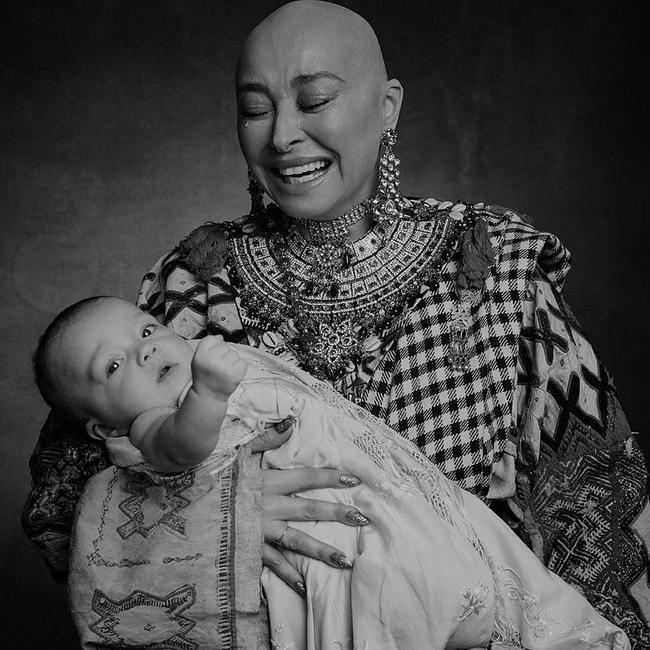 The images Franks shared as she goes through treatment for breast cancer are powerful.