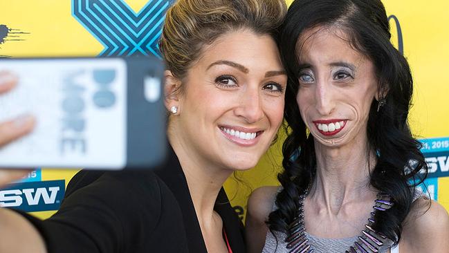 Lizzie Velasquez has more than 626,000 Instagram followers. 