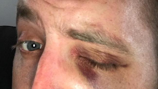 This young officer was kicked in the head at Highpoint shopping centre in Maribyrnong while arresting a young thief on Boxing Day