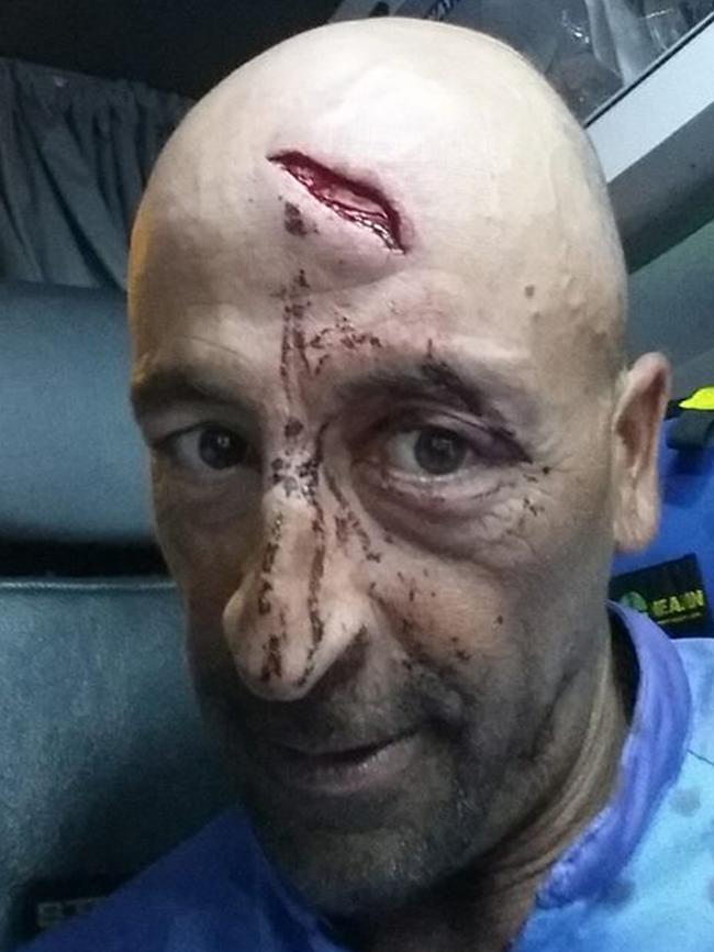 Boat captain Oliver Galea suffered a deep cut.