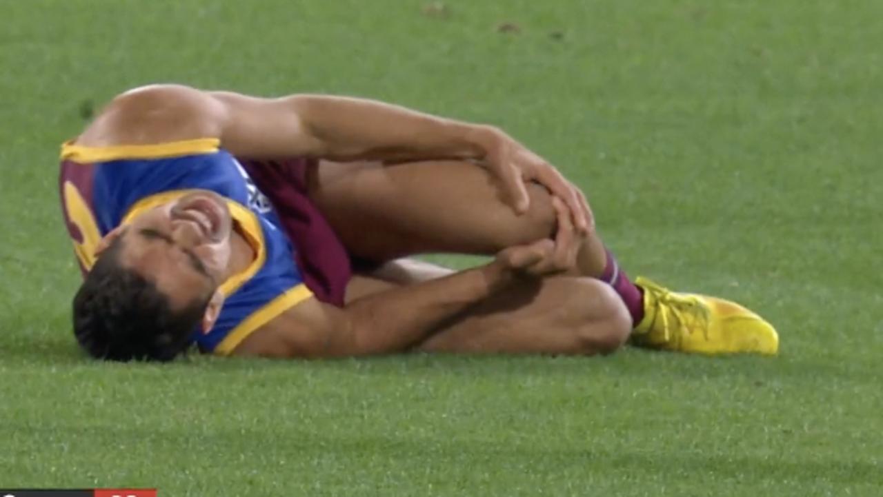 Charlie Cameron was in serious pain after an incident in the final quarter.