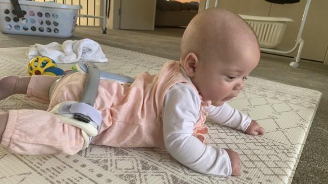 Imogen in a Rhino brace at four months old. Picture: Supplied