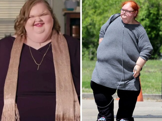 Reality star seen after 140kg weight loss