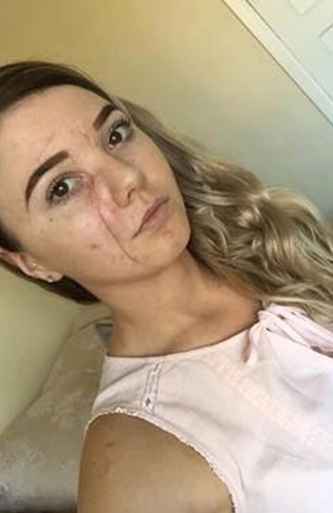 Woman Glassed By Beautician In Pub Fight Removes All Mirrors From Home
