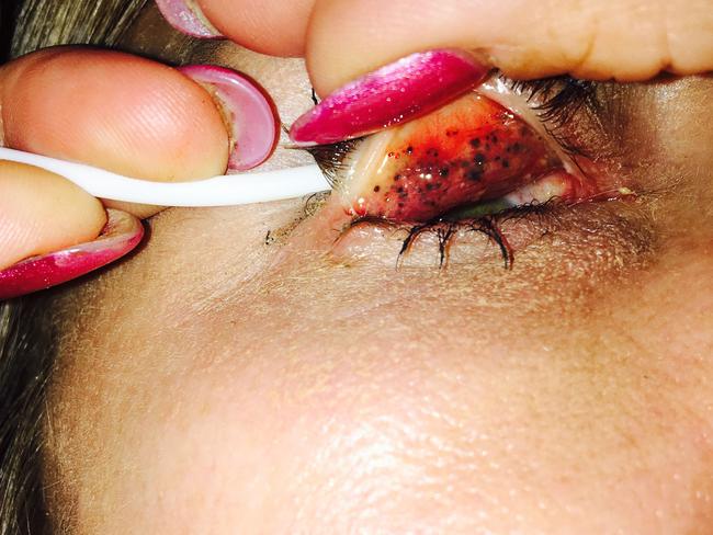 The doctor was horrified to find years of make-up embedded in her eyelids. Picture: Caters