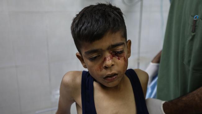 A Palestinian boy injured by Israeli air strikes receives treatment. Picture: Getty Images
