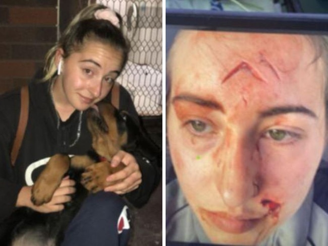 Perth woman mauled by friend’s dog shares warning