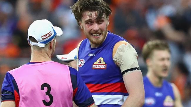 Jordan Roughead reacts after being hit in the eye.