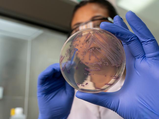 scientist in microbiology laboratory working with E coli culture