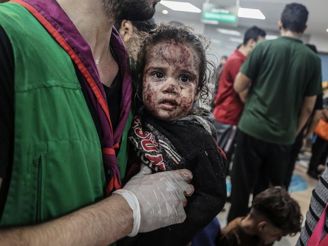 A young Palestinian girl looks on in the arms of a medical worker after scores of injured people arrive at Al-Shifa Hospital following an air strike on Al-Ahli Baptist Hospital in Gaza City on October 17. Picture: Ali Jadallah/Anadolu via Getty Images