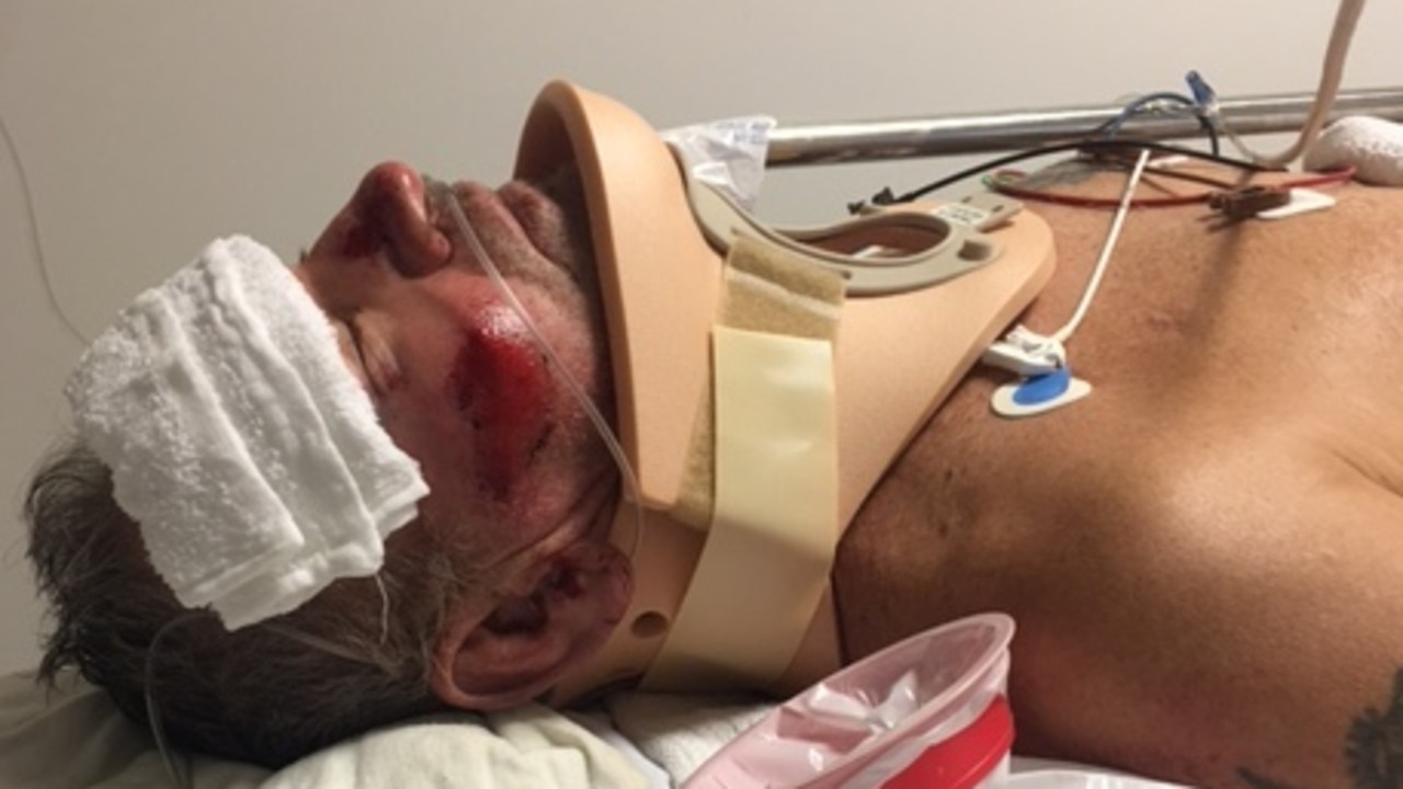 Leopold cyclist Fred May in hospital after being hit by a car in 2019.