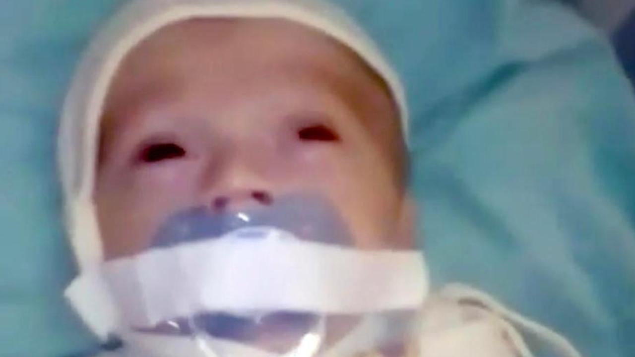 Baby in Russian hospital had mouth covered with sticky tape | Video