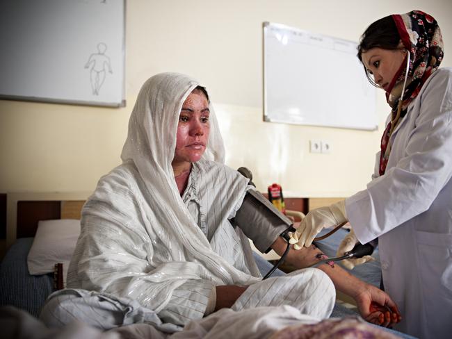 In Afghanistan, cases in which women hurt themselves and damage their own looks to avoid being attacked by men are common. Picture: Getty Images