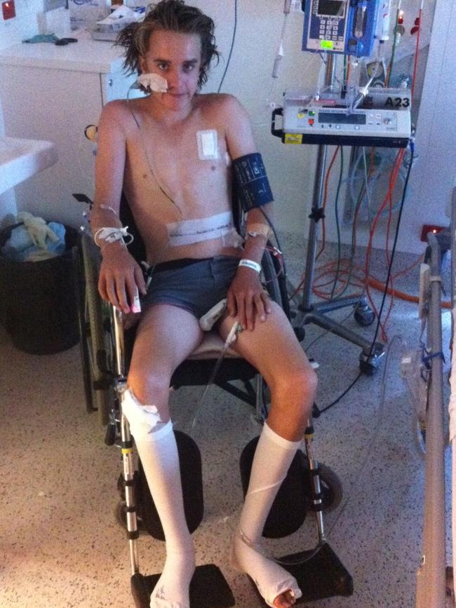 Ryan Meuleman in hospital after being knocked down off his bike by a car in Blairgowrie. Picture: Supplied