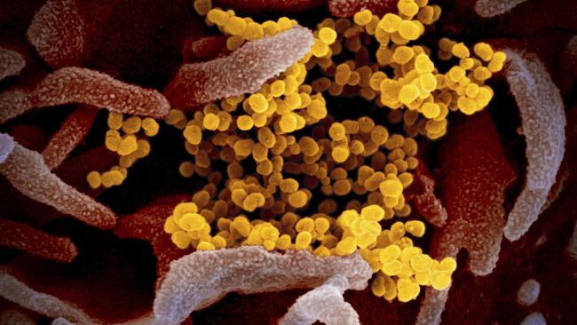 Up close and personal … the Novel Coronavirus SARS-CoV-2 (yellow particles) as seen under an electron microscope. Picture: AP