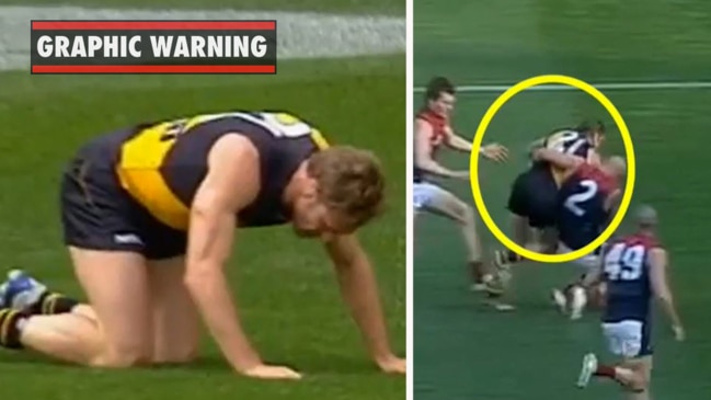 The head knocks Shane Tuck suffered as a Tiger