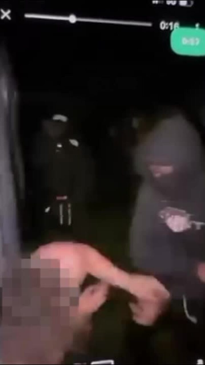 Teen attacked at party