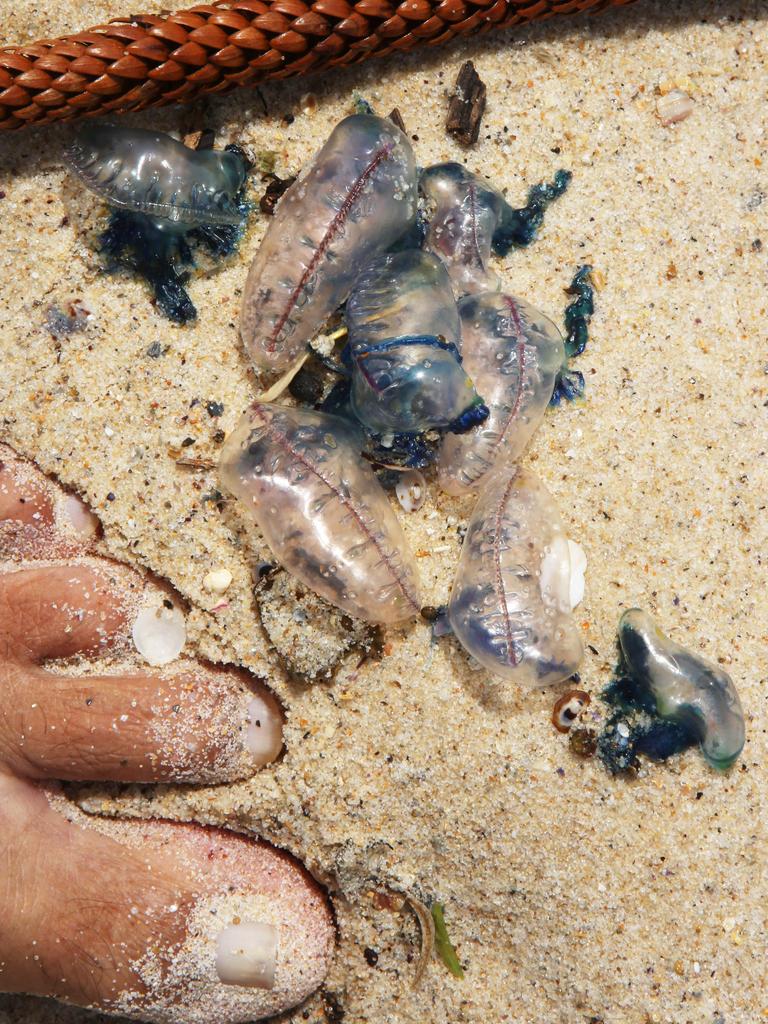 Thousands stung in Australian blue bottle invasion