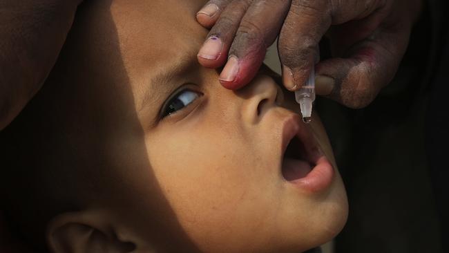 A child is given the polio vaccine in Karachi last month. Picture: AP