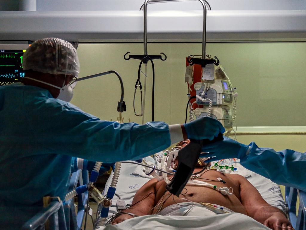 An infected patient is worked on by hospital staff. Picture: Miguel Schincariol/AFP